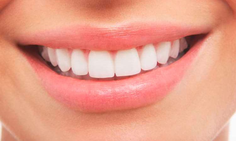 4 Advantages of Professional Teeth Whitening
